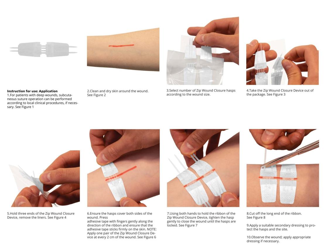 Zipper Wound Closure Bandage – No-Stitch Skin Repair Patch | Fast, Painless Healing
