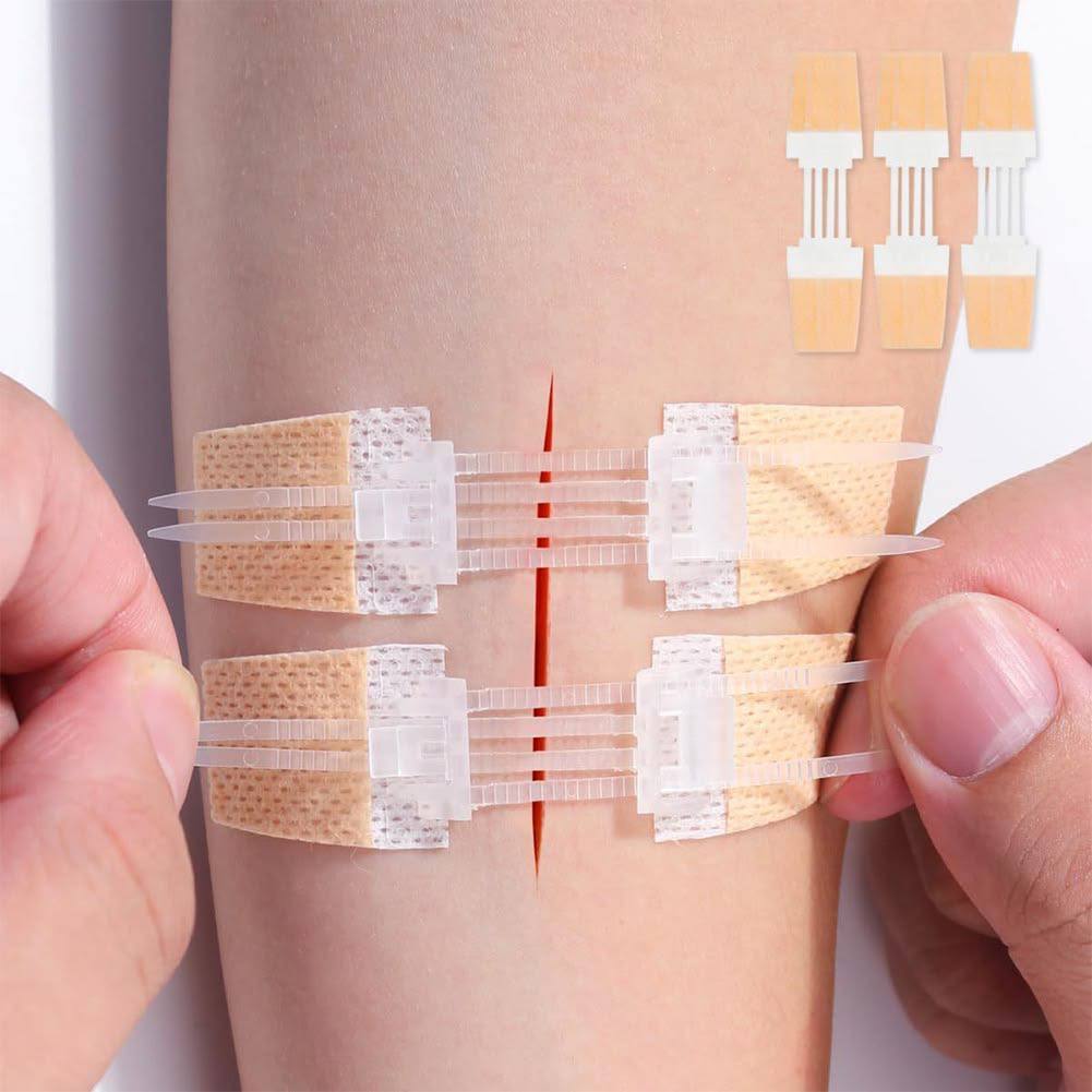Zipper Wound Closure Bandage – No-Stitch Skin Repair Patch | Fast, Painless Healing