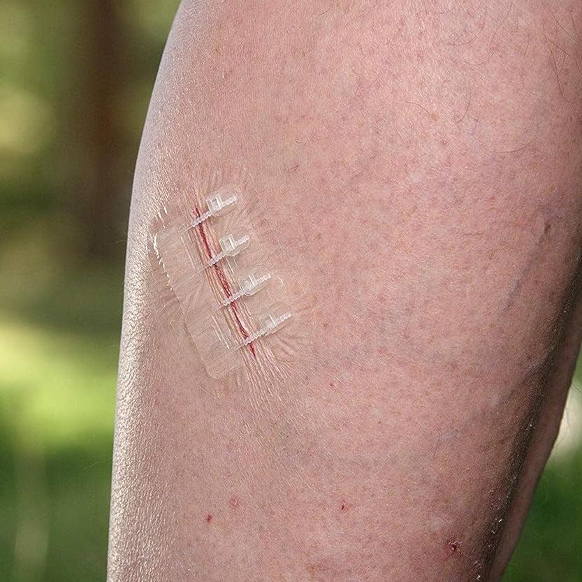 Zipper Wound Closure Bandage – No-Stitch Skin Repair Patch | Fast, Painless Healing