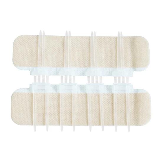 Zipper Wound Closure Bandage – No-Stitch Skin Repair Patch | Fast, Painless Healing